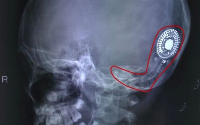 THANH ÂM ĐẦU ĐỜI CỦA CÔ BÉ NGHÈO 7 NĂM SỐNG TRONG THINH LẶNG